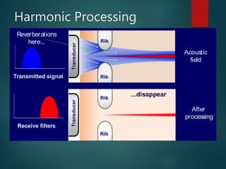 Harmonic Processing
Acoustic
field
After
processing
Reverberations
here...
Transducer
Rib
Rib
Transducer
Rib
Rib
...disappear
Receive filters
Transmitted signal
 