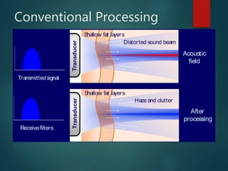 Conventional Processing
Acoustic
field
After
processing
Transducer
Shallow fat layers
Transducer
Shallow fat layers
Haze and clutter
Distorted sound beam
Receivefilters
Transmittedsignal
 