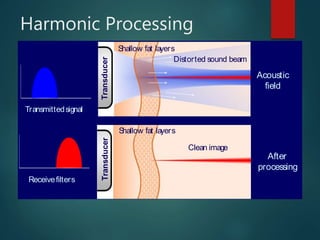 Harmonic Processing
Acoustic
field
After
processing
Transducer
Shallow fat layers
Distorted sound beam
Receivefilters
Transmittedsignal
Clean image
Transducer
Shallow fat layers
 
