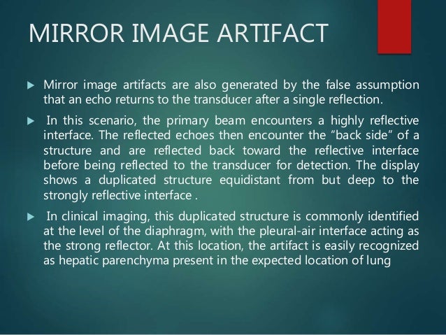 20+ Mirror Image Artefact Gif