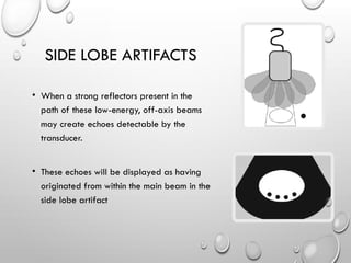 SIDE LOBE ARTIFACTS
• When a strong reflectors present in the
path of these low-energy, off-axis beams
may create echoes detectable by the
transducer.
• These echoes will be displayed as having
originated from within the main beam in the
side lobe artifact
 