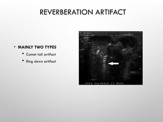 REVERBERATION ARTIFACT
• MAINLY TWO TYPES
 Comet tail artifact
 Ring down artifact
 