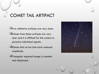 Two reflective surfaces are very close.
Echoes from these surfaces are very
near and it is difficult for the system to
perceive individual signals.
Echoes that arrive late have reduced
amplitude.
Triangular tapered image is created
and displayed.
COMET TAIL ARTIFACT
 