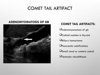 COMET TAIL ARTIFACT
ADENOMYOMATOSIS OF GB
COMET TAIL ARTIFACTS:
Adenomyomatosis of gb
Colloid nodules in thyroid
Biliary hamartoma
Pancreatic calcifications
Small renal or ureteric calculi
Testicular microlithiasis
 