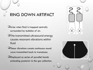 RING DOWN ARTIFACT
Arise when fluid is trapped centrally
surrounded by bubbles of air.
The transmitted ultrasound energy
causes resonant vibrations within
fluid
These vibrations create continuous sound
wave transmitted back to transducer.
Displayed as series of parallel bands
extending posterior to the gas collection.
 