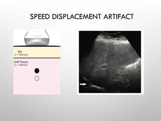 SPEED DISPLACEMENT ARTIFACT
 