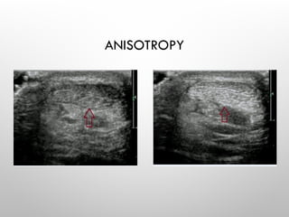ANISOTROPY
 