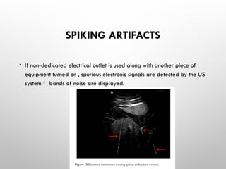 SPIKING ARTIFACTS
• If non-dedicated electrical outlet is used along with another piece of
equipment turned on , spurious electronic signals are detected by the US
system bands of noise are displayed.
 