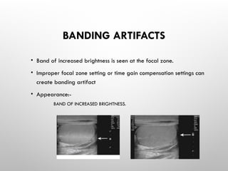 BANDING ARTIFACTS
• Band of increased brightness is seen at the focal zone.
• Improper focal zone setting or time gain compensation settings can
create banding artifact
• Appearance:-
BAND OF INCREASED BRIGHTNESS.
 