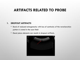ARTIFACTS RELATED TO PROBE
1. DROPOUT ARTIFACTS
• Band of reduced echogenecity with loss of continuity of the reverberation
pattern is noted in the scan field
• Dead piezo elements can results in dropout artifacts.
 