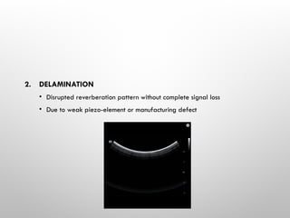 2. DELAMINATION
• Disrupted reverberation pattern without complete signal loss
• Due to weak piezo-element or manufacturing defect
 