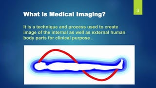 What is Medical Imaging?
It is a technique and process used to create
image of the internal as well as external human
body...