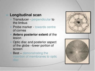 Longitudinal positions
− Detects axial (AP) extent of pathology
− Useful for retinal tears detection
− Shows only 1 clock hour scan
3/15/2013 31
 