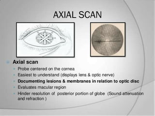 Axial positions
• Probe direct over the cornea
• Pt looks in primary gaze
• US waves pass thru center of lens and hit
optic nerve rather than macula
• Lens density affects the quality of image
3/15/2013 33
 