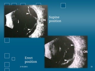 3/15/2013 53
Supine
position
Erect
position
 