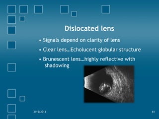 Dislocated lens
• Signals depend on clarity of lens
• Clear lens…Echolucent globular structure
• Brunescent lens…highly reflective with
shadowing
3/15/2013 61
 