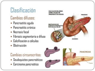 Clasificación
Cambios difusos:
 Pancreatitis aguda
 Pancreatitis crónica
 Necrosis focal
 Fibrosis segmentaria o difusa
 Calcificación o cálculos
 Obstrucción


Cambios circunscritos:
 Seudoquistes pancreáticos
 Carcinoma pancreático
 
