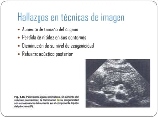 Hallazgos en técnicas de imagen
 Aumento de tamaño del órgano
 Perdida de nitidez en sus contornos
 Disminución de su nivel de ecogenicidad
 Refuerzo acústico posterior
 