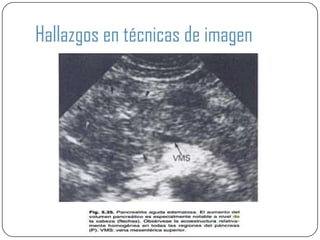 Hallazgos en técnicas de imagen
 