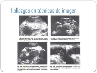 Hallazgos en técnicas de imagen
 