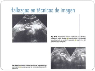 Hallazgos en técnicas de imagen
 