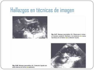 Hallazgos en técnicas de imagen
 