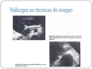 Hallazgos en técnicas de imagen
 