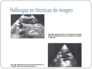 Hallazgos en técnicas de imagen
 