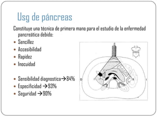 Usg de páncreas
Constituye una técnica de primera mano para el estudio de la enfermedad
  pancreática debido:
 Sencillez
 Accesibilidad
 Rapidez
 Inocuidad


 Sensibilidad diagnostica84%
 Especificidad 93%
 Seguridad 90%
 