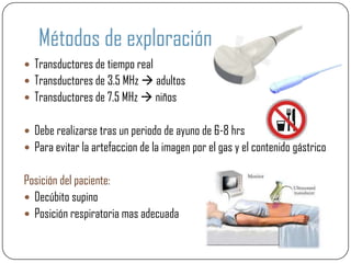 Métodos de exploración
 Transductores de tiempo real
 Transductores de 3.5 MHz  adultos
 Transductores de 7.5 MHz  niños


 Debe realizarse tras un periodo de ayuno de 6-8 hrs
 Para evitar la artefaccion de la imagen por el gas y el contenido gástrico


Posición del paciente:
 Decúbito supino
 Posición respiratoria mas adecuada
 