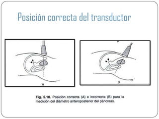 Posición correcta del transductor
 