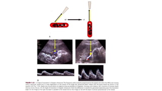 Doppler Ultrasound of Umbilical Artery | PPTX