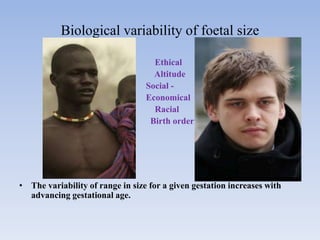 Biological variability of foetal size
Ethical
Altitude
Social -
Economical
Racial
Birth order
• The variability of range in size for a given gestation increases with
advancing gestational age.
 