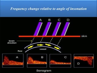 Frequency change relative to angle of insonation
 