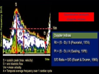 Quantitative analysis
Doppler indices
 