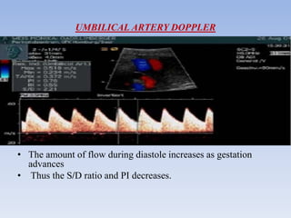 UMBILICAL ARTERY DOPPLER
• The amount of flow during diastole increases as gestation
advances
• Thus the S/D ratio and PI decreases.
 