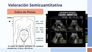 Phelan Normal USG EN EMBARAZO, pruebas diagnósticas de imagen | PPTX