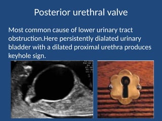 USG evaluation of fetal anomalies[Replica].pptx