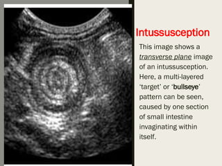 Intussusception In Dogs USG GI tract of dog prepare by dr.Pravin Chaudhary.pptx
