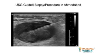 USG Guided Biopsy/Procedure in Ahmedabad
 
