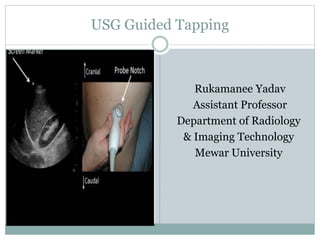 USG Guided Tapping
Rukamanee Yadav
Assistant Professor
Department of Radiology
& Imaging Technology
Mewar University
 