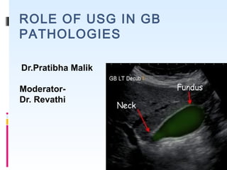 ROLE OF USG IN GB
PATHOLOGIES
Dr.Pratibha Malik
Moderator-
Dr. Revathi
 