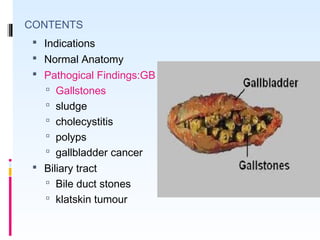 CONTENTS
 Indications
 Normal Anatomy
 Pathogical Findings:GB
 Gallstones
 sludge
 cholecystitis
 polyps
 gallbladder cancer
 Biliary tract
 Bile duct stones
 klatskin tumour
 