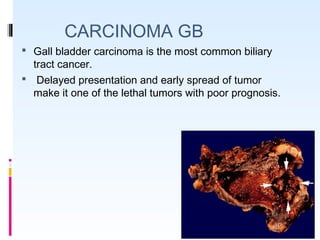 CARCINOMA GB
 Gall bladder carcinoma is the most common biliary
tract cancer.
 Delayed presentation and early spread of tumor
make it one of the lethal tumors with poor prognosis.
 