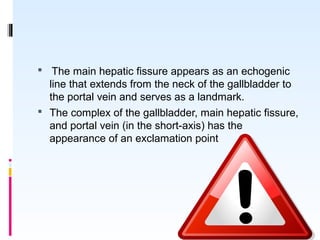   The main hepatic fissure appears as an echogenic
line that extends from the neck of the gallbladder to
the portal vein and serves as a landmark.
 The complex of the gallbladder, main hepatic fissure,
and portal vein (in the short-axis) has the
appearance of an exclamation point
08/03/14
 