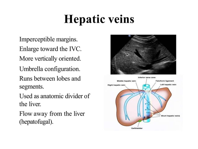 Liver cirrhosis USG | PPTX