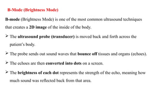 Comprehensive Overview of Ultrasound Modes: A-Mode, M-Mode, and B-Mode ...