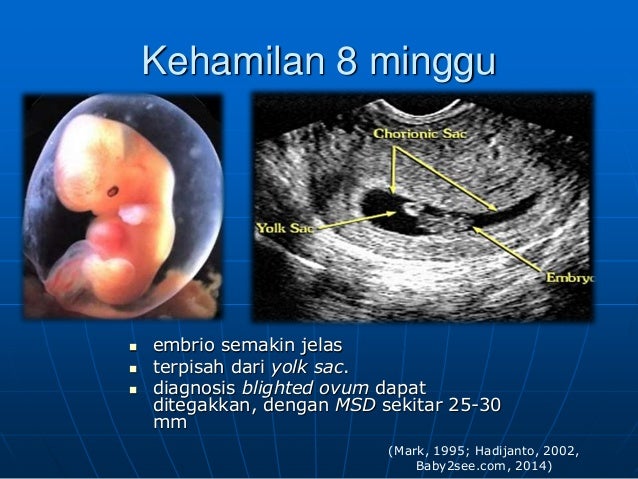  Gambar  Usg  4 Dimensi  Janin 8 Bulan