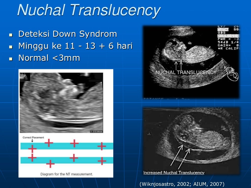 USG dasar dalam kehamilan