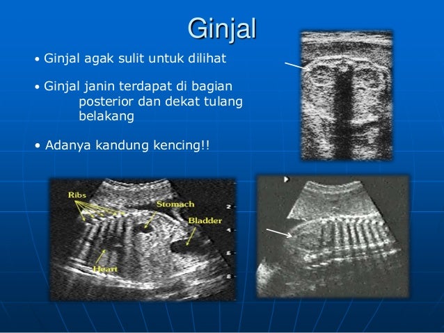 USG dasar dalam kehamilan USG dasar dalam kehamilan